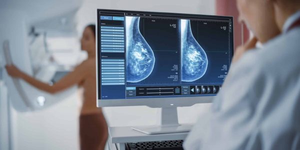 Computer,Screen,In,Hospital,Radiology,Room:,Beautiful,Multiethnic,Adult,Woman