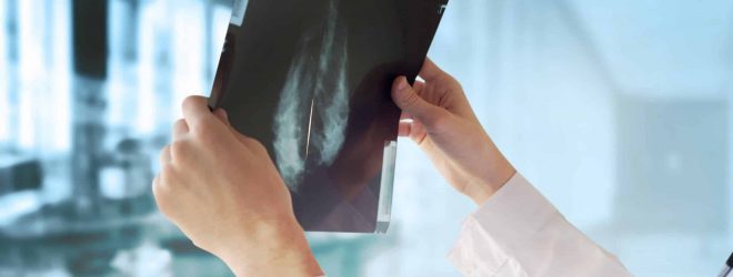 Doctor,With,Mammography